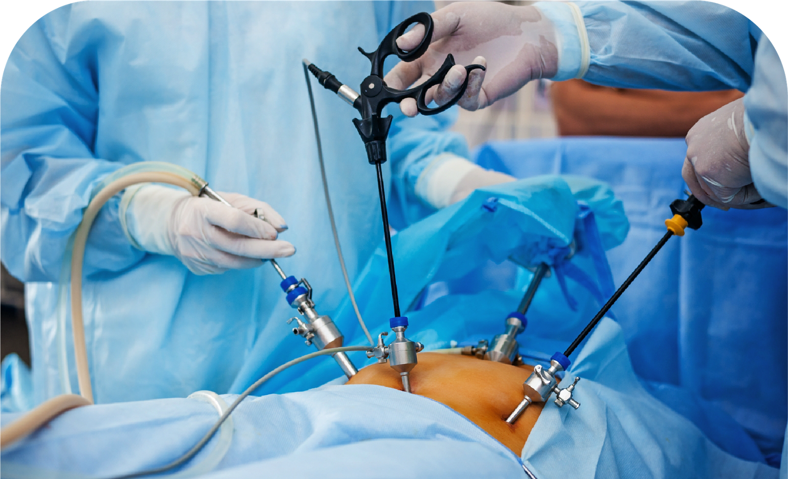 laparoscopic urologist doctors in Gota
