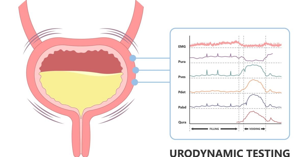 Expert Urodynamic Evaluation & Treatment for Neurogenic Bladder in Ahmedabad