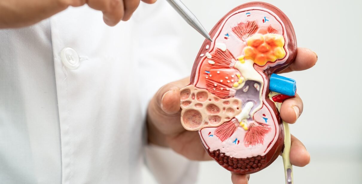 Kidney Stones Urinary Stones Treatment in Ahmedabad