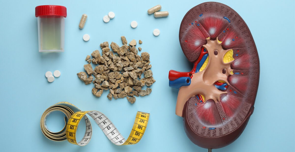 Professional Treatments in Kidney Stone Treatment in Ahmedabad