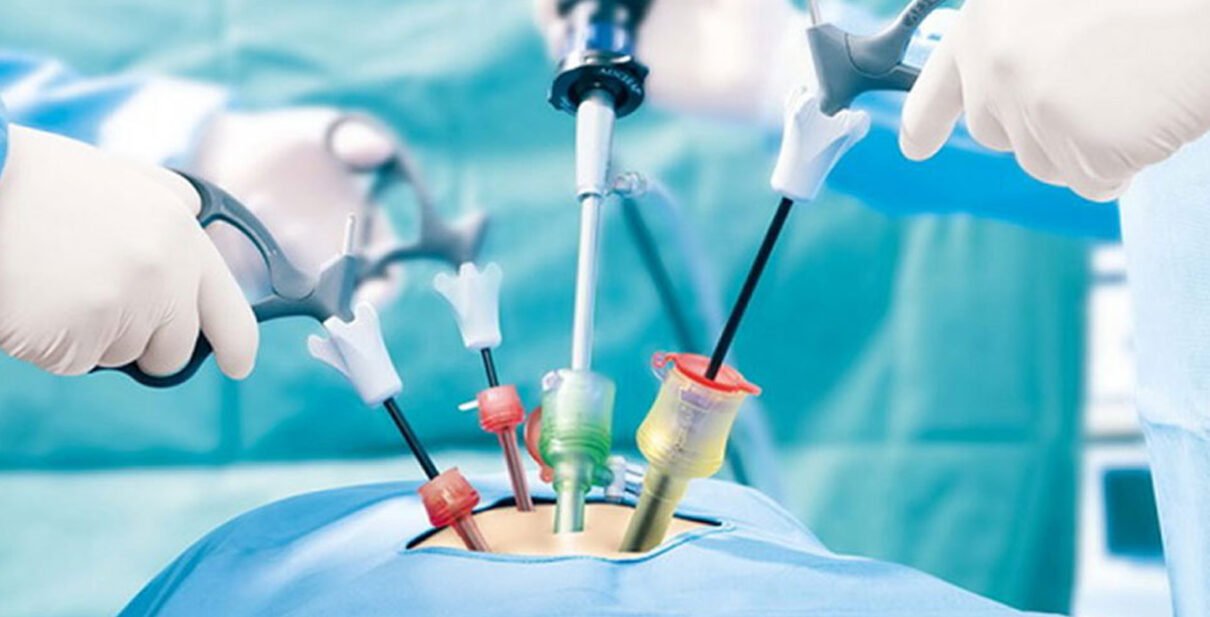 Laparoscopic urology surgeon in Ahmedabad minimally invasive kidney adrenal prostate surgery Dr. Hardik Yadav urologist