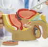 Prostate operation cost Ahmedabad TURP HoLEP radical prostatectomy prostate laser surgery Dr. Hardik Yadav urologist